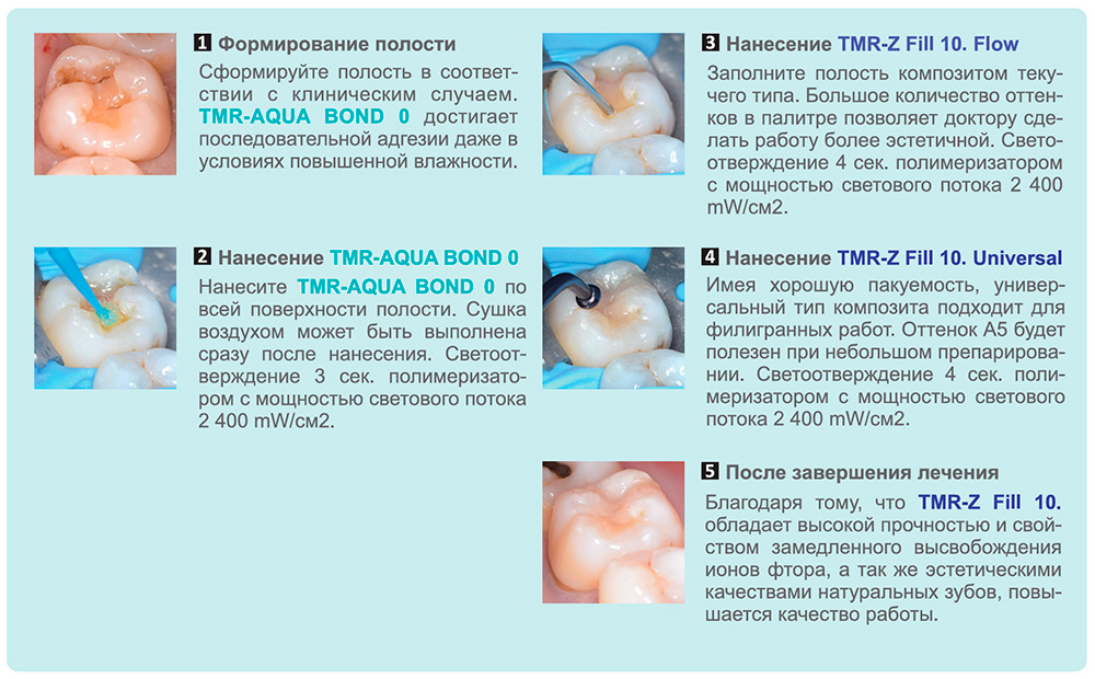 Ямакинаквабонд10